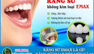 Răng sứ Emax