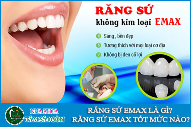 Răng sứ Emax