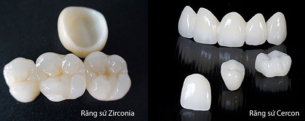 Răng sứ Zicora và răng sứ cercon
